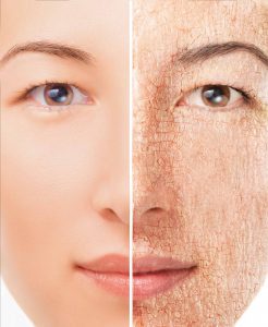 What Is Dry Skin? Here What You Need to Know.