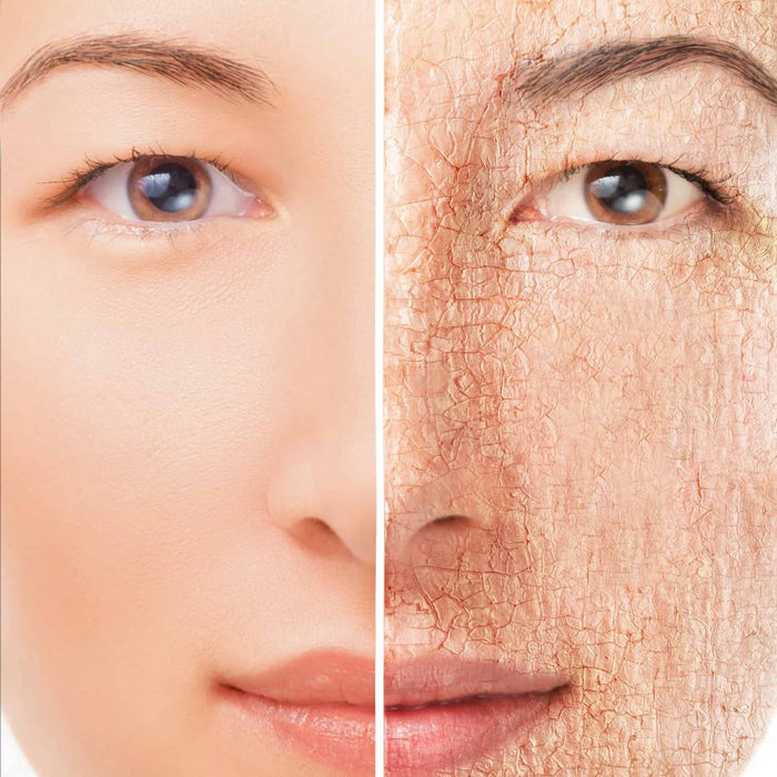 What are Dermatologists' tips for treating dry skin?