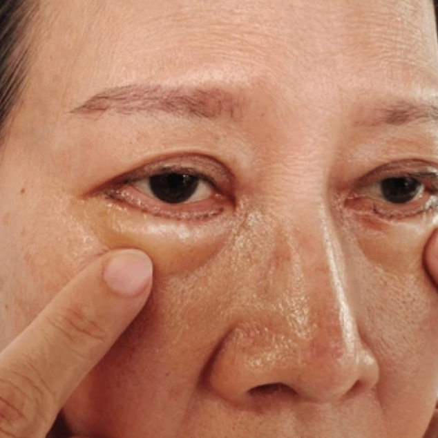  irritation eye cream, puffiness, dark circles, eye bags