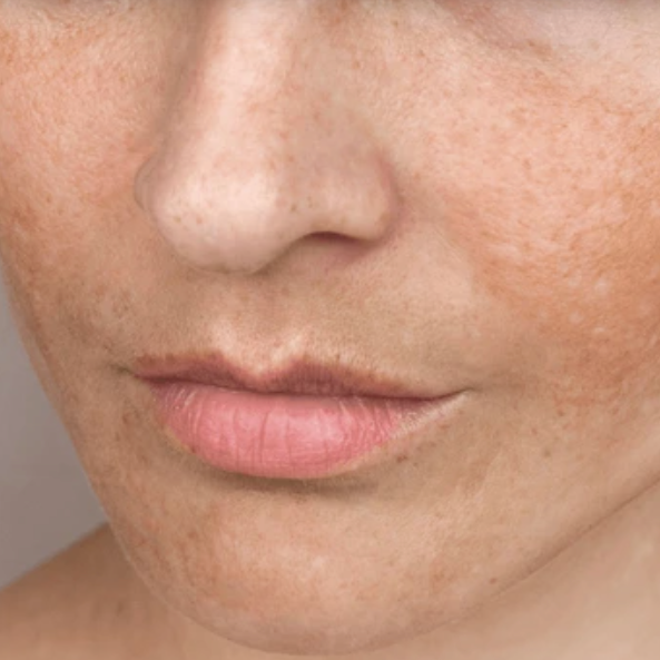gentle skincare routine for sensitive skin