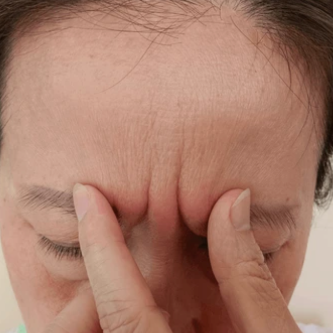 skin barrier damage