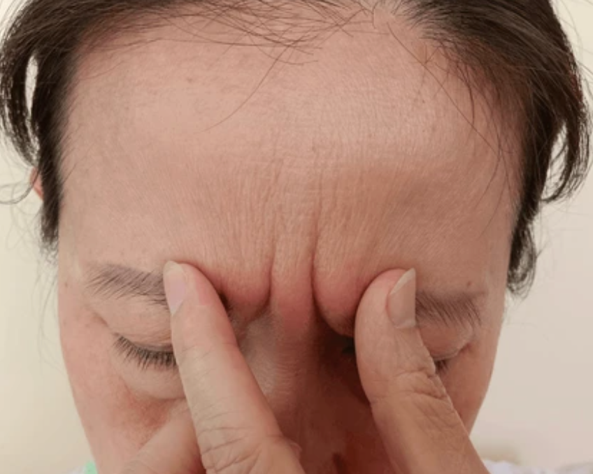 skin barrier damage
